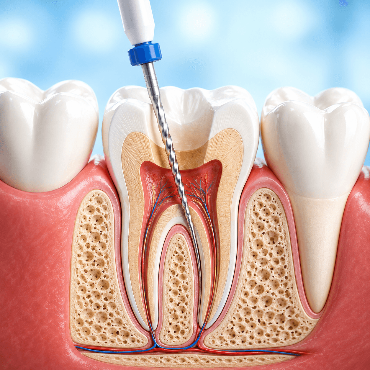 Tooth model showing root canal anatomy for endodontic treatment
