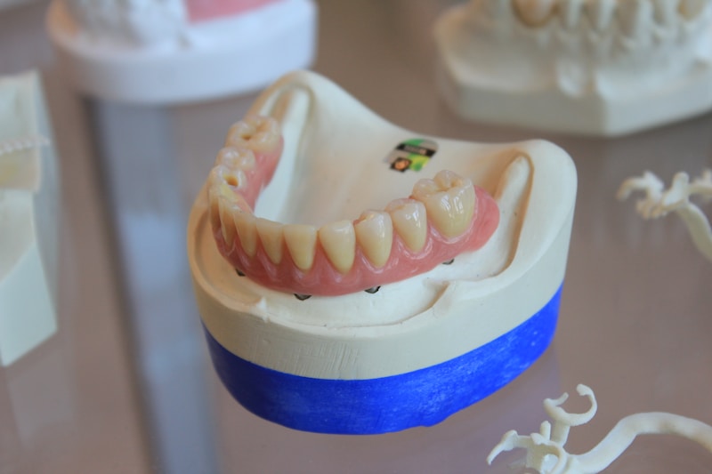 Custom denture set for full and partial tooth replacement at Englewood Dentistry