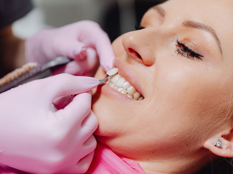 Dentist placing porcelain veneer on a patient tooth at Englewood Dentistry