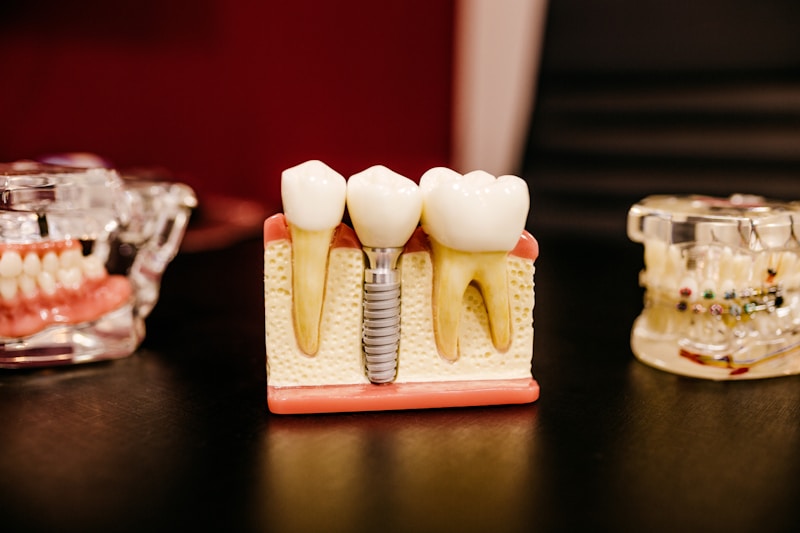 Tooth model showing root canal anatomy for endodontic treatment at Englewood Dentistry